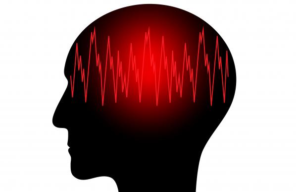Image cerveau épilepsie
